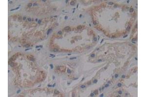 Figure. (IFNAR2 antibody  (AA 27-243))
