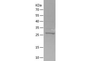 Western Blotting (WB) image for Cytochrome C Oxidase Subunit VIIc (COX7C) (AA 1-63) protein (His-IF2DI Tag) (ABIN7283722) (COX7C Protein (AA 1-63) (His-IF2DI Tag))