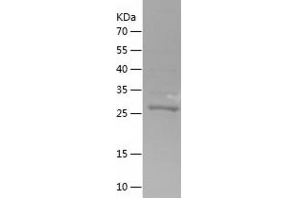 COX7C Protein (AA 1-63) (His-IF2DI Tag)
