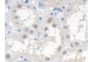 Detection of SMN2 in Human Kidney Tissue using Polyclonal Antibody to Survival Of Motor Neuron 2, Centromeric (SMN2) (SMN2 antibody  (AA 16-251))