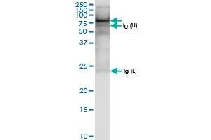 Immunoprecipitation of ASMTL transfected lysate using anti-ASMTL MaxPab rabbit polyclonal antibody and Protein A Magnetic Bead , and immunoblotted with ASMTL MaxPab rabbit polyclonal antibody (D01) . (ASMTL antibody  (AA 1-621))