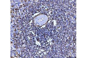 IHC analysis of CD20 using anti-CD20 antibody (ABIN7599180). (CD20 antibody  (AA 1-261))