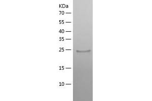 Western Blotting (WB) image for Abhydrolase Domain Containing 14B (ABHD14B) (AA 1-210) protein (His tag) (ABIN7288382) (ABHD14B Protein (AA 1-210) (His tag))