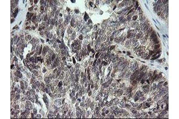 KIF25 antibody