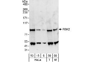 Western Blotting (WB) image for anti-Ribosomal Protein S6 Kinase, 90kDa, Polypeptide 3 (RPS6KA3) (AA 1-50) antibody (ABIN7454552)