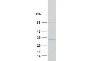 Western Blotting (WB) image for Nuclear Transcription Factor Y, beta (NFYB) protein (Myc-DYKDDDDK Tag) (ABIN2727238)