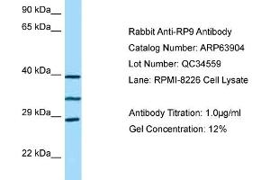 Western Blotting (WB) image for anti-Retinitis Pigmentosa 9 (Autosomal Dominant) (RP9) (C-Term) antibody (ABIN2789660) (RP9 antibody  (C-Term))