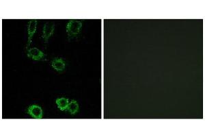 Immunofluorescence (IF) image for anti-Calponin 2 (CNN2) (Internal Region) antibody (ABIN1850970) (CNN2 antibody  (Internal Region))
