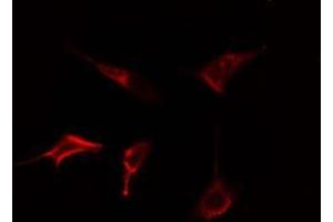 ABIN6278565 staining Hela cells by IF/ICC. (DOK5 antibody  (C-Term))