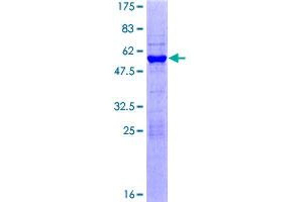 RNF4 Protein (AA 1-190) (GST tag)
