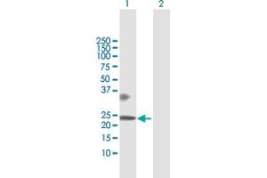 Western Blot analysis of BTC expression in transfected 293T cell line by BTC MaxPab polyclonal antibody.