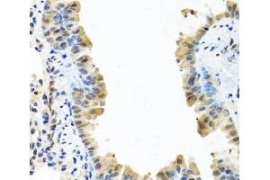 ARSF antibody
