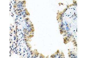 Immunohistochemistry of paraffin-embedded Mouse lung using ARSF Polyclonal Antibody at dilution of 1:100 (40x lens). (ARSF antibody)
