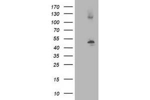 HEK293T cells were transfected with the pCMV6-ENTRY control (Left lane) or pCMV6-ENTRY TUBB4 (Right lane) cDNA for 48 hrs and lysed. (TUBB4 antibody)