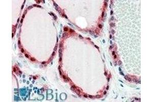 AP22449PU-N FZD2 antibody staining of paraffin embedded Human Thyroid Gland at 2. (FZD2 antibody  (Internal Region))