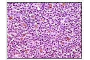 Immunohistochemical analysis of paraffin-embedded human lymphnode tissues using MCL1 antibody with DAB staining. (MCL-1 antibody)