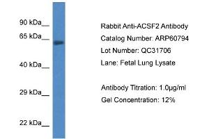 Western Blotting (WB) image for anti-Acyl-CoA Synthetase Family Member 2 (ACSF2) (C-Term) antibody (ABIN2788584) (ACSF2 antibody  (C-Term))