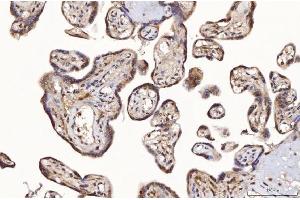 IHC analysis of TTC11/FIS1 using anti-TTC11/FIS1 antibody (ABIN7600321).