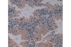Used in DAB staining on fromalin fixed paraffin- embedded testis tissue (IL-4 antibody  (AA 21-140))