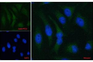 ABIN185521 Immunofluorescence analysis of paraformaldehyde fixed HeLa cells, permeabilized with 0. (Patched 1 antibody  (C-Term))
