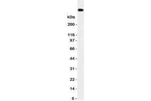 Western blot testing of DNA PKcs antibody and HeLa cell lysate.