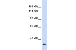 Western Blotting (WB) image for anti-MDM2 Binding Protein (MTBP) (Middle Region) antibody (ABIN2446252) (MTBP antibody  (Middle Region))