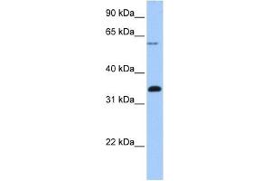 FBXO16 antibody used at 1 ug/ml to detect target protein. (FBXO16 antibody  (C-Term))