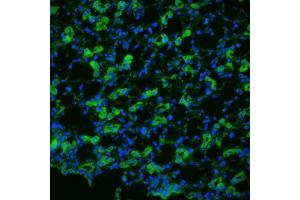 Immunohistochemistry analysis using Rabbit Anti-Aquaporin 1 Polyclonal Antibody . (Aquaporin 1 antibody  (N-Term))