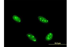 Immunofluorescence of monoclonal antibody to NFIA on HeLa cell. (NFIA antibody  (AA 1-498))