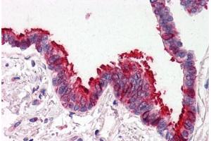 Human Lung, Respiratory Epithelium (formalin-fixed, paraffin-embedded) stained with SKIL antibody ABIN214478 at 2. (SKIL antibody  (N-Term))