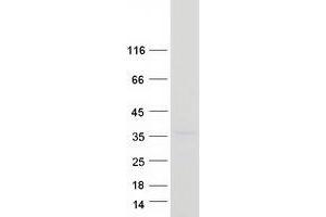 Validation with Western Blot (CLDND1 Protein (Transcript Variant 2) (Myc-DYKDDDDK Tag))