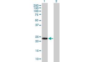 Western Blot analysis of RAB39B expression in transfected 293T cell line by RAB39B MaxPab polyclonal antibody. (RAB39B antibody  (AA 1-213))