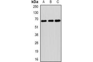 Western blot analysis of SOCS4 expression in MCF7 (A), mouse liver (B), mouse spleen (C) whole cell lysates. (SOCS4 antibody)