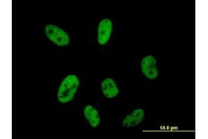 Immunofluorescence of purified MaxPab antibody to CPSF2 on HeLa cell. (CPSF2 antibody  (AA 1-782))