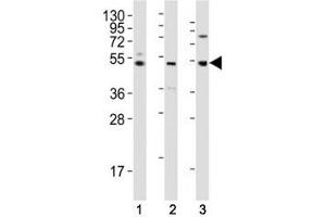 Western blot testing of LAG3 antibody at 1:2000 dilution tested on human lysates, Lane 1: K562; 2: liver; 3: ovary; Predicted molecular weight ~54 kDa. (LAG3 antibody  (AA 103-132))