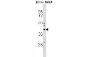 MFF Antibody (Center) (ABIN1537829 and ABIN2838250) western blot analysis in NCI- cell line lysates (35 μg/lane). (MFF antibody  (AA 133-162))