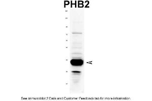 WB Suggested Anti-PHB2 Antibody Titration: 1 ug/mlPositive Control: Rat tissue (Prohibitin 2 antibody  (C-Term))