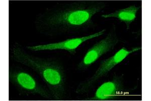 Immunofluorescence of monoclonal antibody to PPHLN1 on HeLa cell.