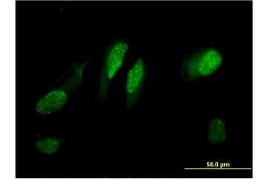 Immunofluorescence of monoclonal antibody to C13orf15 on HeLa cell.