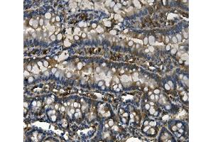 IHC analysis of RENT1/hUPF1 using anti-RENT1/hUPF1 antibody (ABIN7602979). (RENT1/UPF1 antibody  (Middle Region))