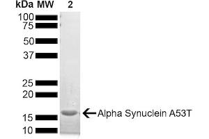 SDS-PAGE of ~14 kDa A53T Alpha Synuclein Monomer (ABIN6952300, ABIN6952301 and ABIN6952302) (SNCA Protein (Ala53Thr-Mutant))