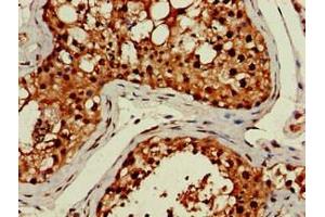 Immunohistochemistry of paraffin-embedded human testis tissue using ABIN7158320 at dilution of 1:100 (LHFPL5 antibody  (AA 46-99))