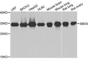Western blot analysis of extracts of various cell lines, using SBDS antibody.