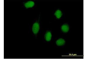Immunofluorescence of purified MaxPab antibody to WHSC1L1 on HeLa cell. (WHSC1L1 antibody  (AA 1-645))