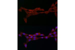Immunofluorescence analysis of NIH/3T3 cells using Alph-adaptin/ Rabbit pAb (ABIN6130980, ABIN6136955, ABIN6136957 and ABIN6221039) at dilution of 1:50 (40x lens).