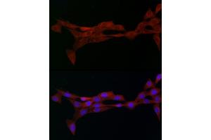 Immunofluorescence analysis of NIH/3T3 cells using Alph-adaptin/ Rabbit pAb (ABIN6130980, ABIN6136955, ABIN6136957 and ABIN6221039) at dilution of 1:50 (40x lens). (AP2A2 antibody  (AA 590-939))