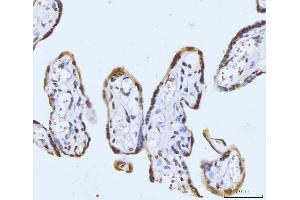 IHC analysis of GHITM using anti-GHITM antibody (ABIN7599294). (GHITM antibody  (AA 1-345))