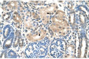 Human kidney (UBE2E2 antibody  (N-Term))