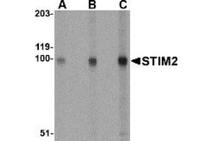 Western Blotting (WB) image for anti-Stromal Interaction Molecule 2 (Stim2) (Middle Region) antibody (ABIN1031110) (Stim2 antibody  (Middle Region))