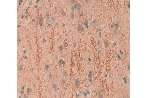 Used in DAB staining on fromalin fixed paraffin- embedded brain tissue (INPP4A antibody  (AA 1-137))